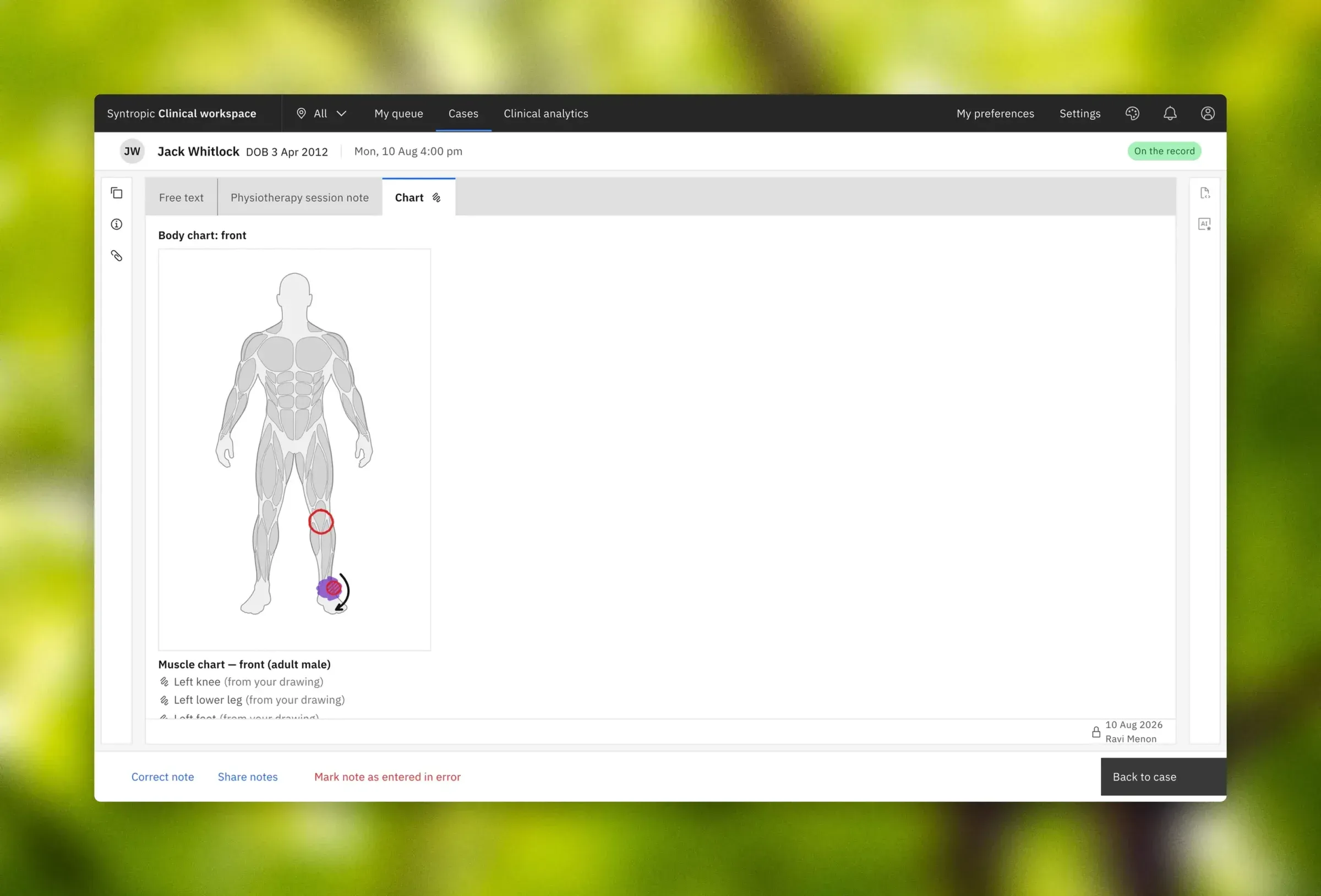 A body chart marked during a session